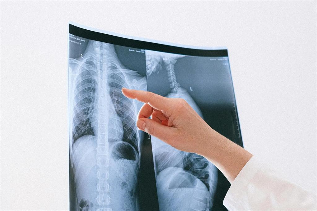 FDA Approves Ardelyx's Kidney Disease-Related Drug